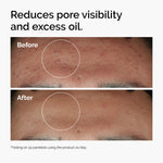 Niacinamide 10% + Zinc 1% 30ml